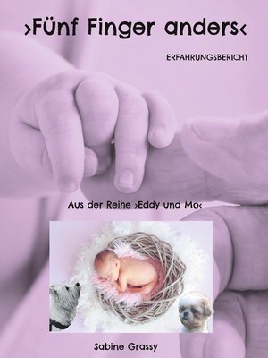 cover image of Fünf Finger anders